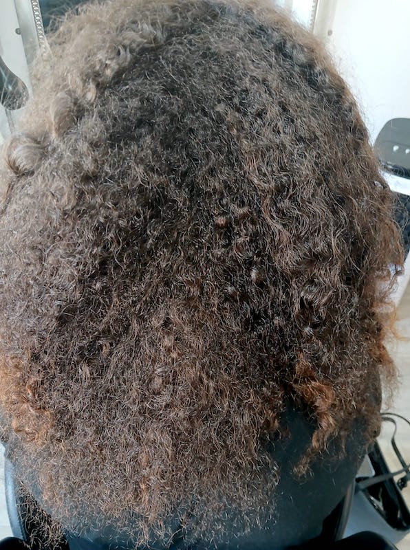 Before-Before / After